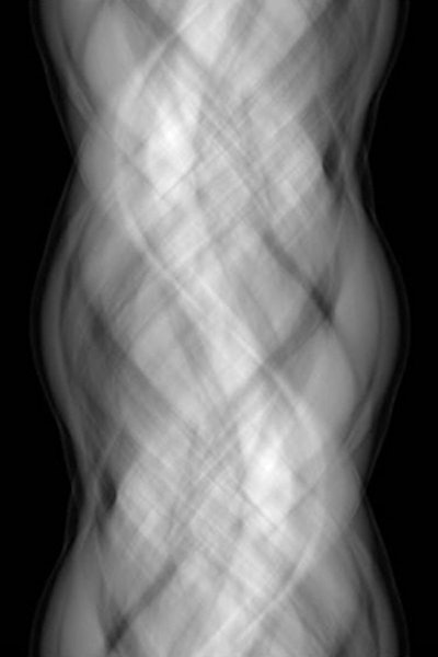 The ability for radiologists to interact directly with the raw CT data (sinogram) may lead to improved diagnostic efficacy and confidence. Image courtesy of Dr. Eliot Siegel.
