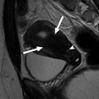 2013 08 22 15 52 17 592 Mrkh Mri Rad 01 440 20130822225543