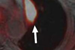 2013 08 29 16 04 51 437 Rad Sept Pet Mri Nodules 01 450 20130829230754