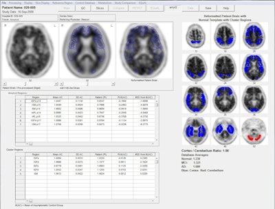 NeuroQ software