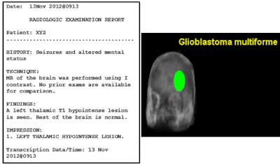 A text-based radiology report versus the VITA 3D visual report. VITA 3D visual reports place radiological observations into a 3D volumetric context designed to make radiology reports more comprehensible to patients and enhance physician-patient communication. Image courtesy of Sharmili Roy.