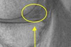 2013 10 14 13 59 42 873 Lalaji Medial Mri 450 20131014210605