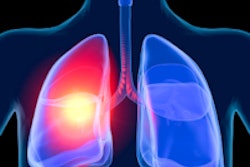 2013 10 29 12 59 42 384 Lungs 200