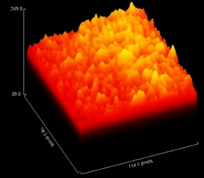 Z-axis display of peak amplitude in the region of interest.