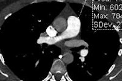 2013 11 21 14 41 36 84 Bolen bottom 450 20131121214756