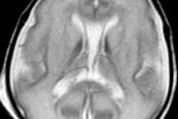 2013 11 25 15 56 37 58 Bluml Mrs Image Rsna 02 400 20131125230347