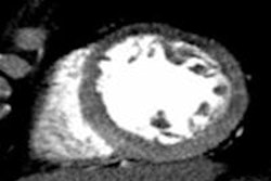 2013 11 26 17 12 15 437 Rybicki core320 cta 450 20131127001418