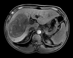 An mDixon scan using Philips' Ingenia MRI system with dStream. Image courtesy of Philips.