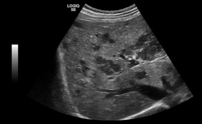 Image from GE's Logiq S8 general-purpose scanner. Courtesy of GE.