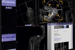 2013 12 04 15 43 28 684 Siemens Syngovia Screenshot 450