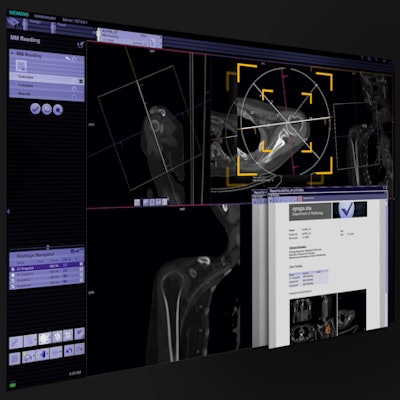 Siemens is highlighting its syngo.via software.