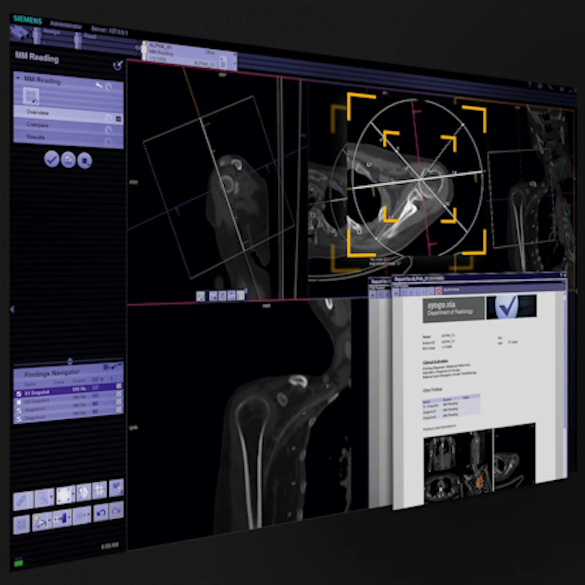 Siemens RSNA launches include Force CT scanner, angio unit | AuntMinnie