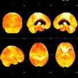 2013 12 05 11 31 02 103 Friedman Petmri 500 20131205183335