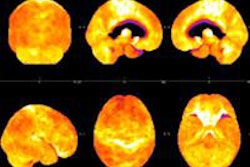2013 12 05 11 31 02 103 Friedman Petmri 500 20131205183335