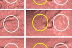 2013 12 05 12 32 29 678 Shin 8mm Sessile Polyp 500 20131205193600