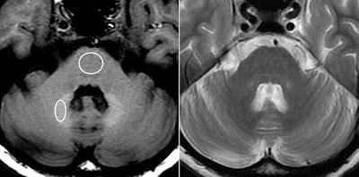 2013 12 17 15 26 12 989 Gadolinium 1c 1d 500