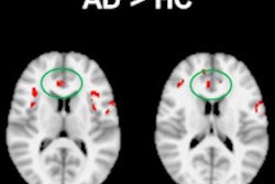 2013 12 20 13 49 20 55 2013 12 24 F Mri Alzheimers 200