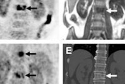 2014 02 06 17 40 07 614 Pet Ct Mri Eiber 01 500 20140207004334