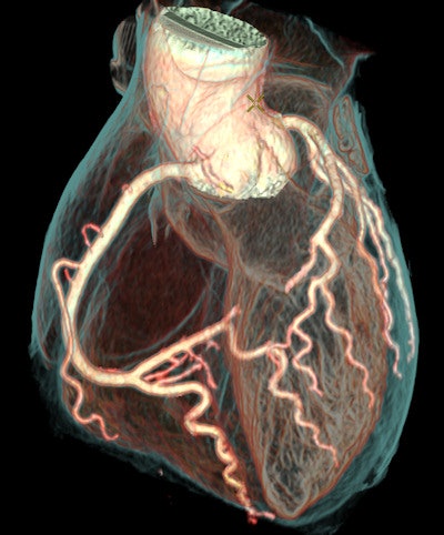 Image courtesy of Girish Muralidharan of GE Healthcare.