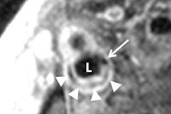 2014 03 04 11 23 26 792 Figure2a Bluemke 400 20140304183428