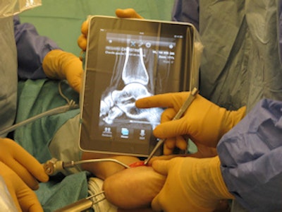 A mobile device used during orthopedic surgery. Image courtesy of Dr. Mathieu Assal, University Hospital of Geneva.