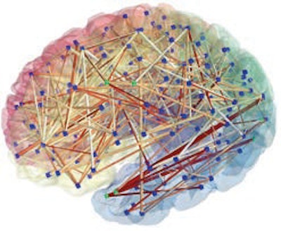 The brain represented as a network: Image obtained from MR connectomics.