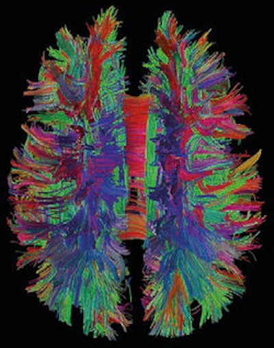 White matter fiber pathways of the brain as depicted with MR tractography. All images courtesy of Patric Hagmann, CHUV-UNIL, Lausanne, Switzerland.