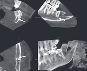 Cone-beam CT