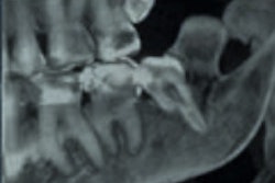 2014 03 09 16 03 45 876 2014 03 09 Teeth Thumb