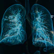 2014 04 15 15 51 17 897 Lung Xray 3 D 200