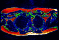 2014 04 17 23 20 09 947 2014 04 18 Mri Brown Fat