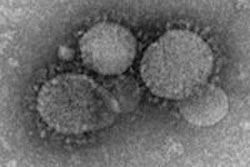 2014 01 31 14 27 22 437 Mers Coronavirus 250 20140131212839