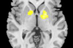 2014 05 02 15 21 58 490 F Mri Adhd Rad 01 500 20140502222831
