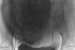 2014 05 20 15 20 44 51 Uae Clinical 500 20140520222850