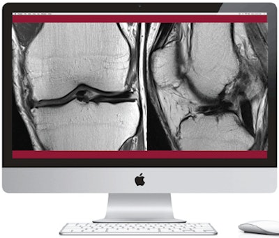 Real View Radiology uses two monitors side by side to train residents, with MR images on the left monitor (shown above) and a series of questions on the right (shown below). Images provided by Real View Radiology.