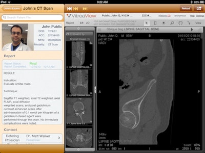 Screenshot of REACH. The top left-hand corner demonstrates the active videoconferencing session, while the bottom left of the screen shows the radiologist report associated with the study. The right side of the screen contains the study itself, loaded into an HTML5 lightweight PACS viewer. Image courtesy of Dr. Paras Khandheria.