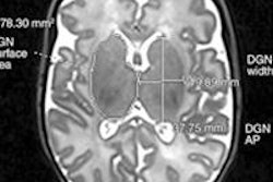 2014 06 06 14 37 56 739 Mri 03 Rad Pretrm Kids 475 20140606214021