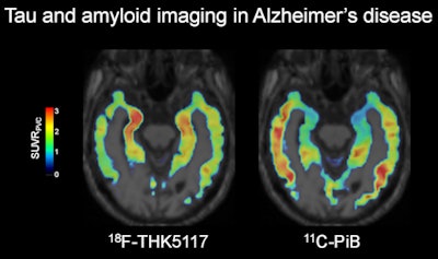 Image courtesy of SNMMI.