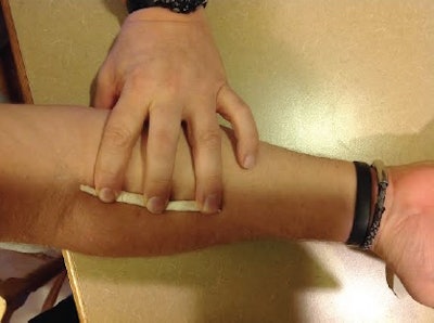Figure 2: Roll some of the tape and place it on the thumb side of the forearm.