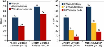 Incidence of vascular calcification present or absent and extent of vascular disease among ancient and modern Egyptians after excluding modern patients > 60 years of age.