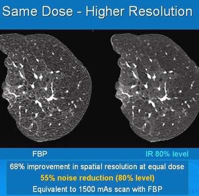 Iterative reconstruction provided 68% improvement in spatial resolution at an equal dose. All images courtesy of Dr. Jeffrey Mendel.