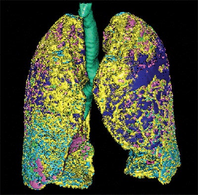 Sagittal reformatted CT images