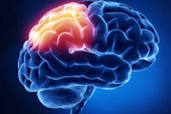 2014 08 11 16 18 45 343 Brain 200