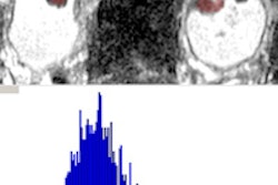 2014 08 14 15 10 54 672 Rosenkrantz Histogram 200