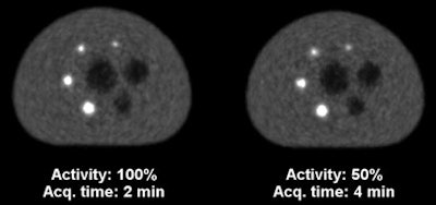 PET image quality as FDG activity decreases over time and data acquisition time increases. Above and below, radiotracer activity was reduced by half (100%, 50%, 25%, and 12.5%), while data acquisition times doubled (two, four, eight, and 16 minutes). Differences in overall quality were hardly perceivable. Images courtesy of JNM.