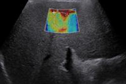 2014 08 27 16 15 07 954 Elastography 20140827231859