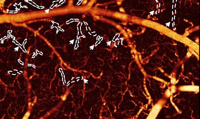 Blood flow in mouse after cocaine