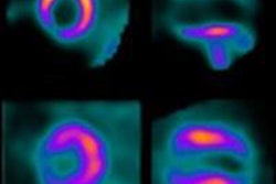 2014 08 28 16 38 28 936 B W Spect Mri Einstein 400 20140828234041
