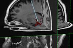 2014 09 02 11 53 12 646 Insert Mri 20140902190218