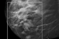 2014 09 03 16 38 17 143 Senoclaire Case2 200